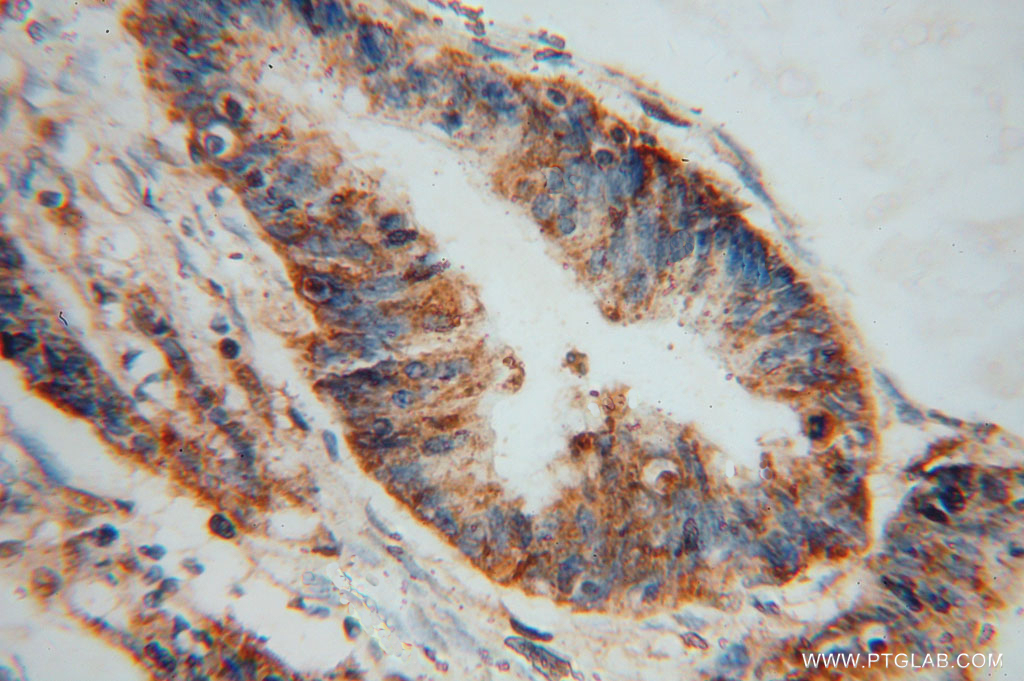 PDXK Polyclonal antibody