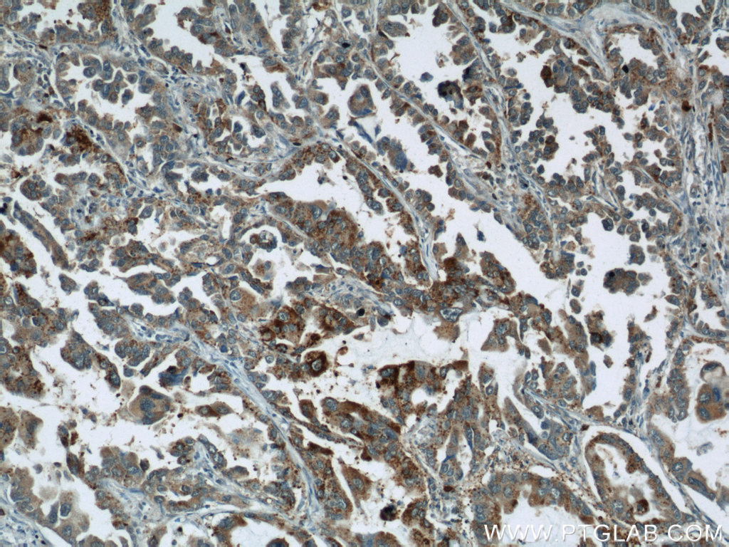 STXBP2 Polyclonal antibody