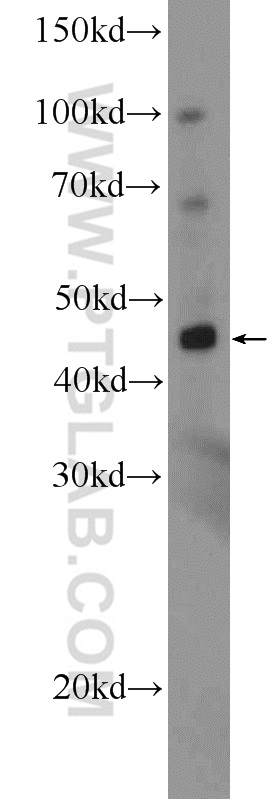 MPPE1 Polyclonal antibody