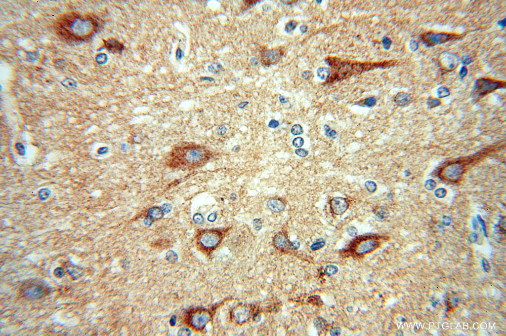 SCAMP1 Polyclonal antibody