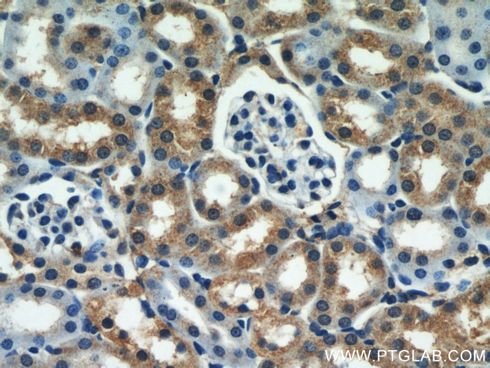 SEPX1 Polyclonal antibody