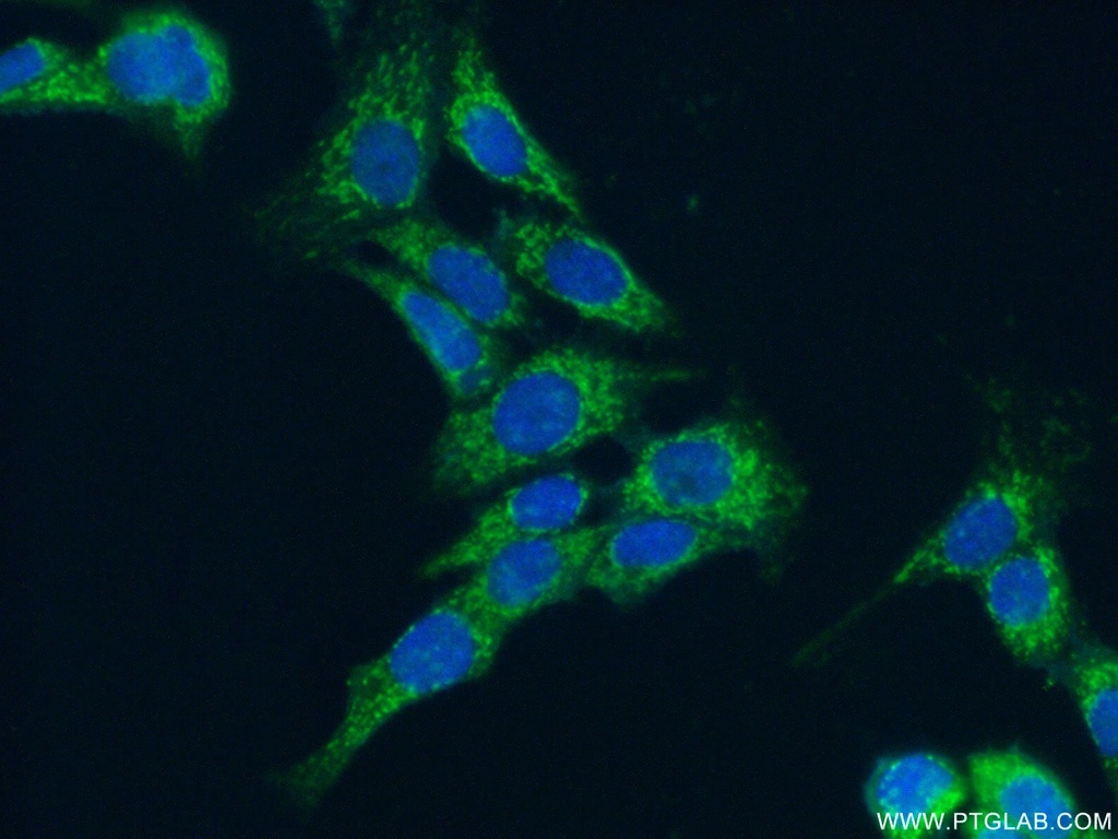 MRPL9 Polyclonal antibody