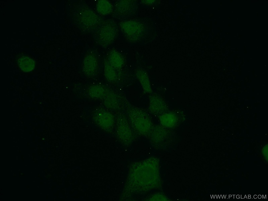 MAD2L1BP Polyclonal antibody