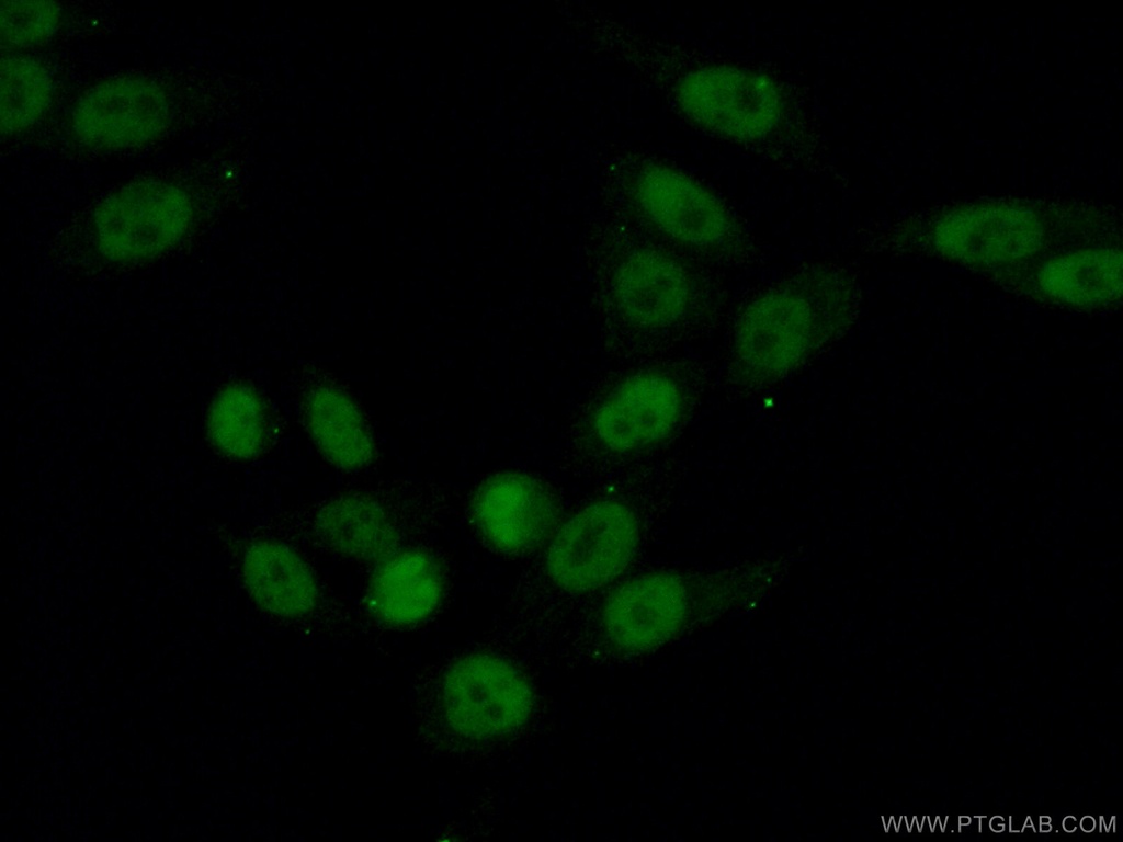 UBA2 Polyclonal antibody