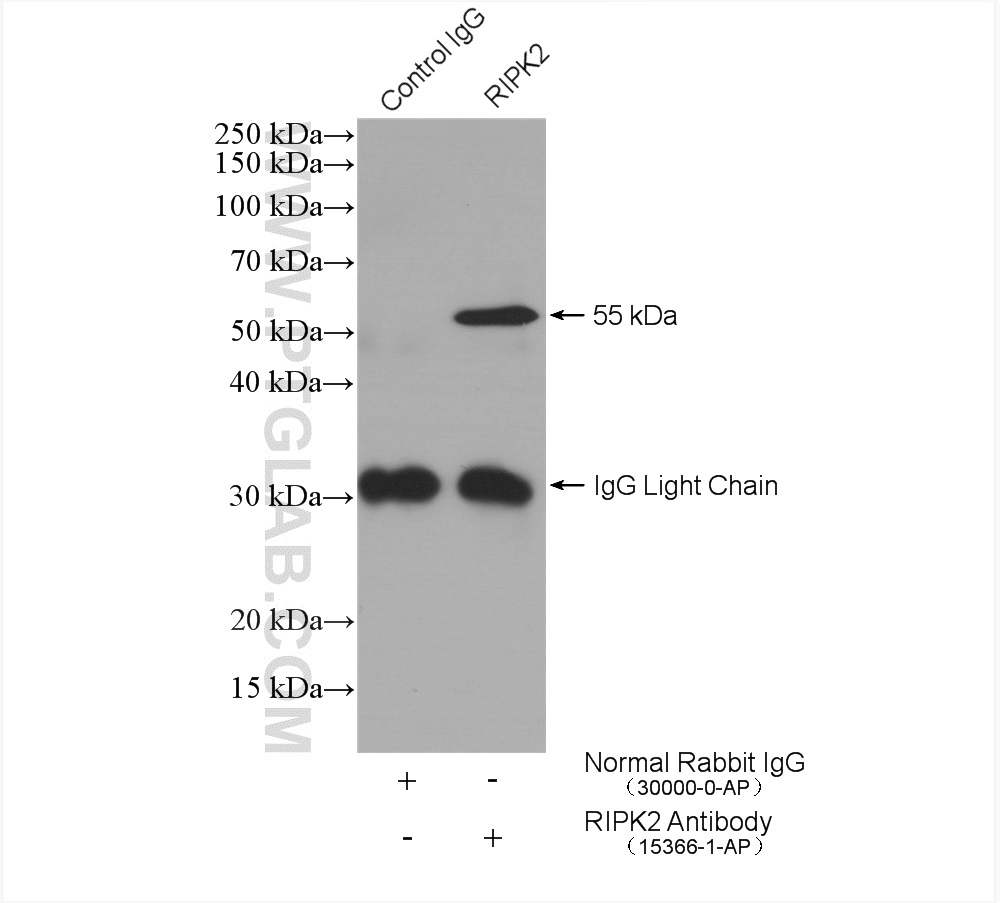 RIPK2 Polyclonal antibody