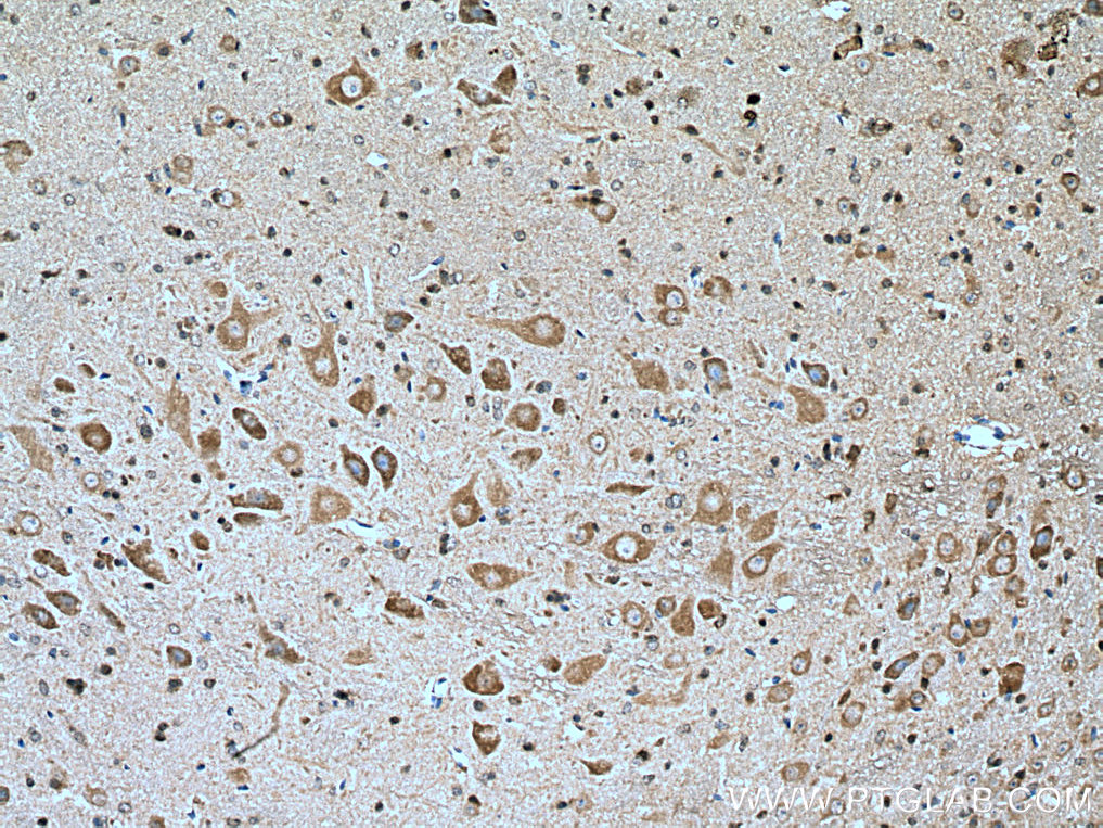 GLRB Polyclonal antibody