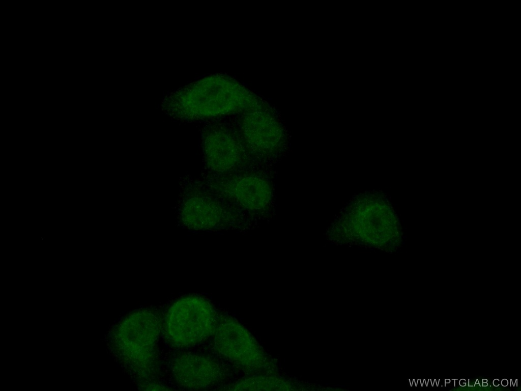 GNB3 Polyclonal antibody