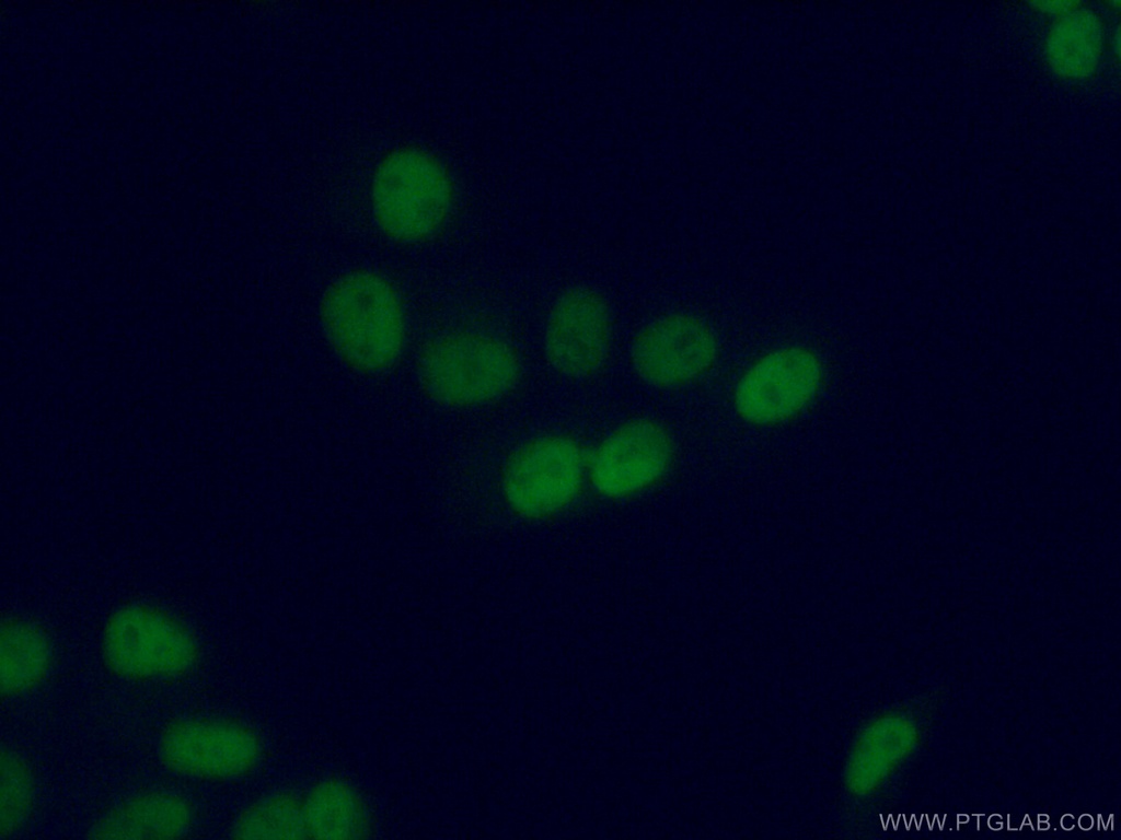 PRMT6 Polyclonal antibody