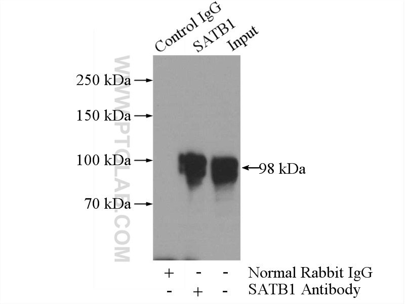 SATB1 Polyclonal antibody