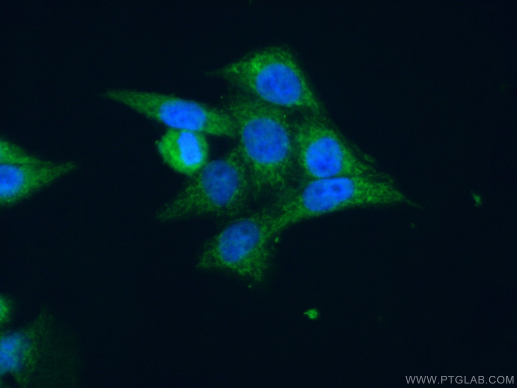 MAPKAPK3 Polyclonal antibody