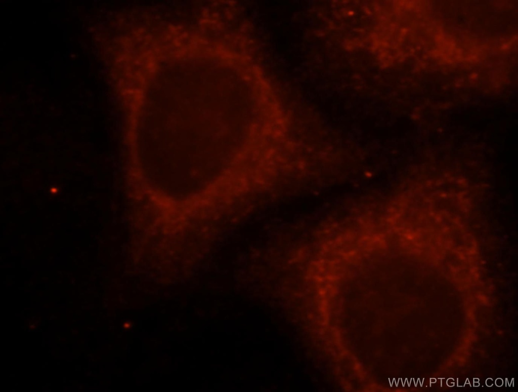 UGT2B4 Polyclonal antibody
