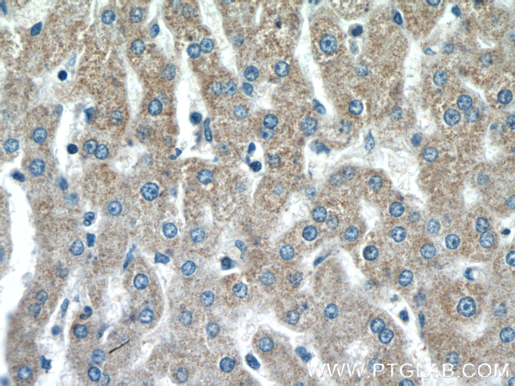 SSU72 Polyclonal antibody