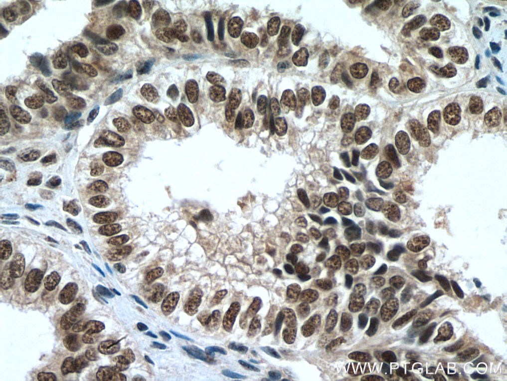 PAF1 Polyclonal antibody