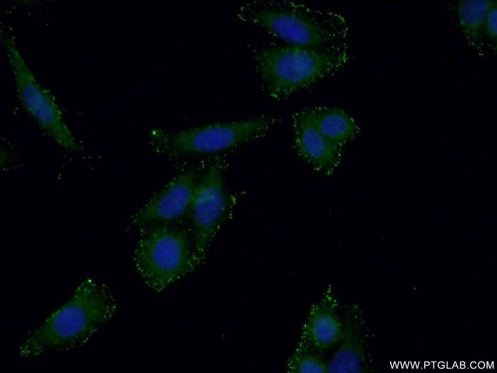 GMDS Polyclonal antibody
