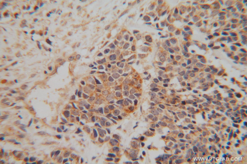 NDUFA6 Polyclonal antibody