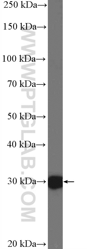 HOXC8 Polyclonal antibody