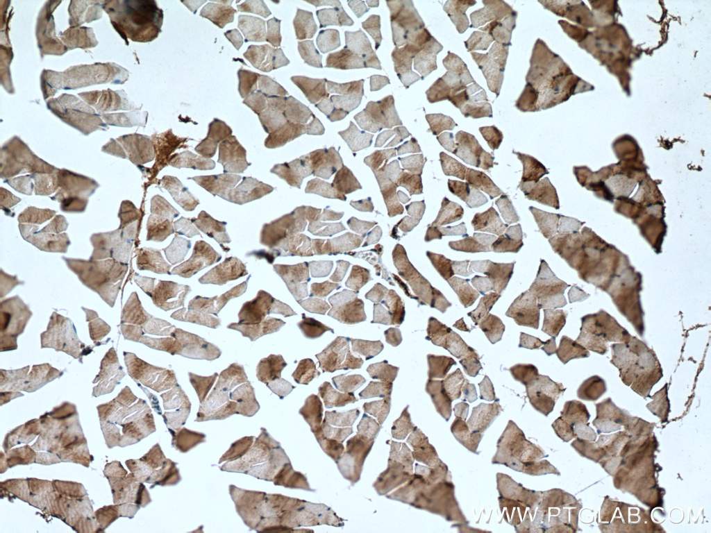 NSUN5 Polyclonal antibody