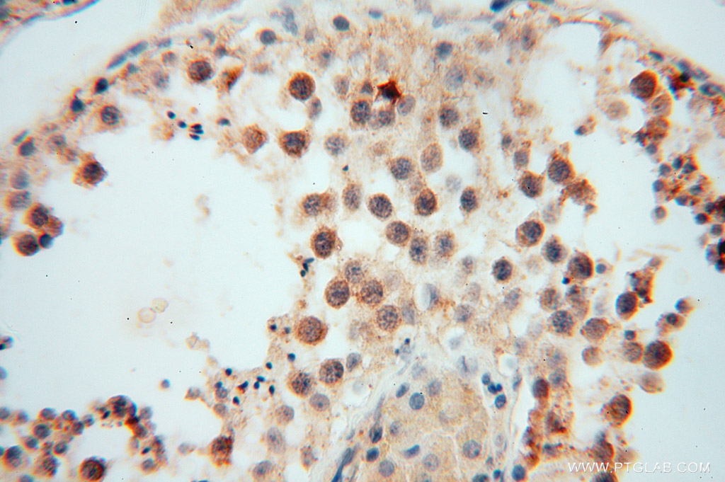 MYLIP Polyclonal antibody
