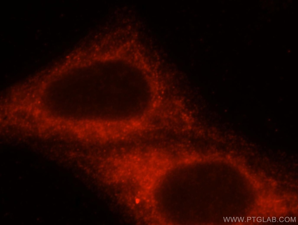 HOOK3 Polyclonal antibody
