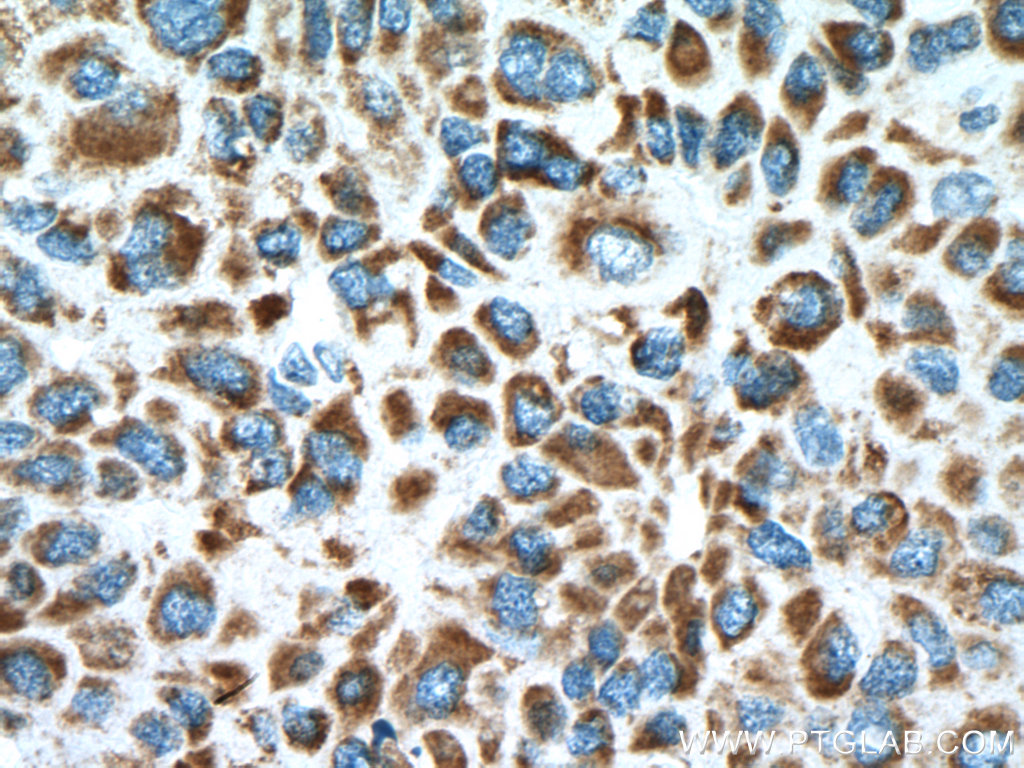 MDH2 Polyclonal antibody
