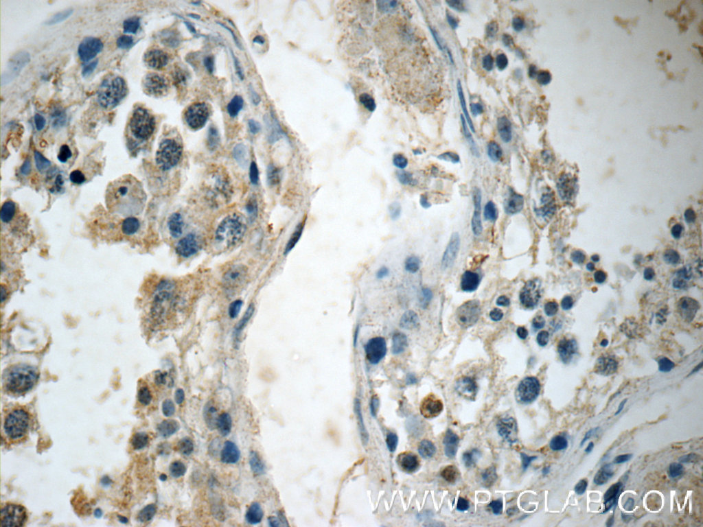 ALKBH7 Polyclonal antibody