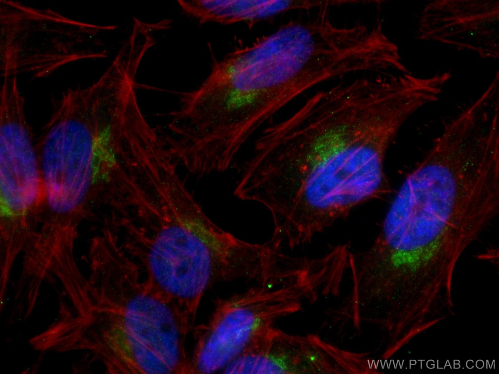 YIPF4 Polyclonal antibody
