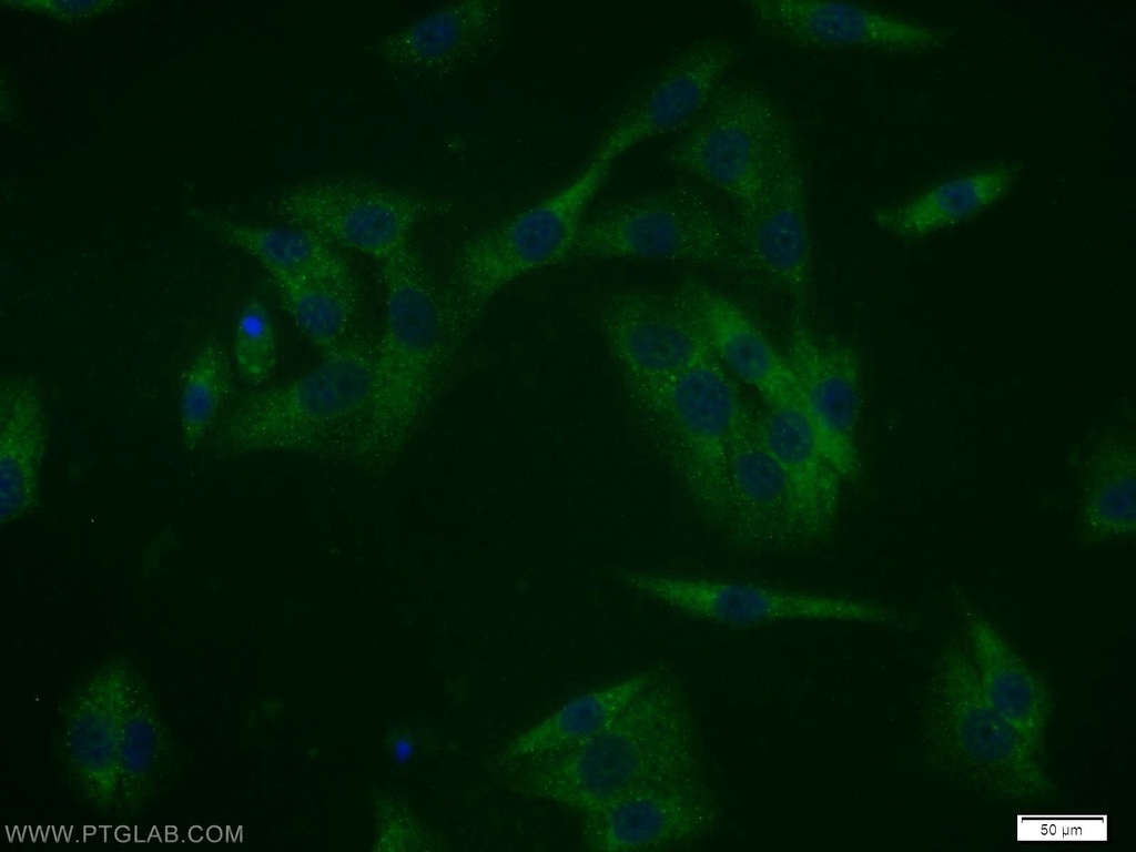 MAGEA11 Polyclonal antibody