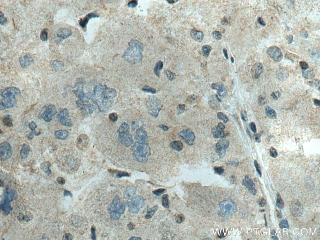 ADK Polyclonal antibody