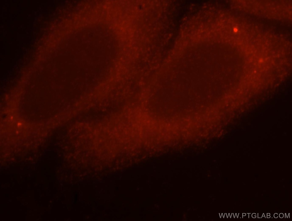 UNC45A Polyclonal antibody