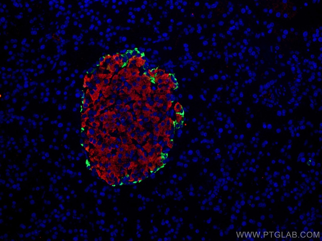 Pancreatic Polypeptide Polyclonal antibody
