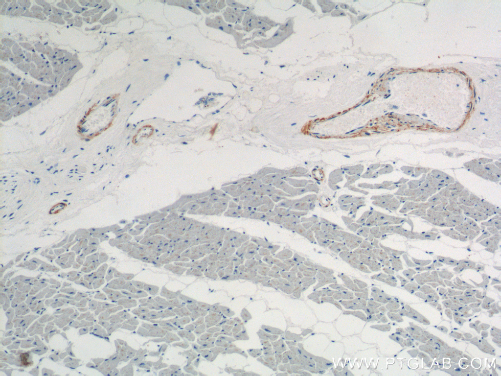 transgelin/SM22-specific Polyclonal antibody