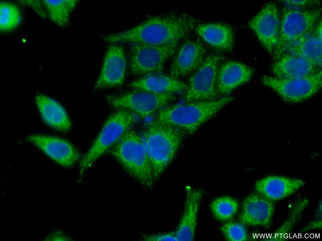 HACL1 Polyclonal antibody