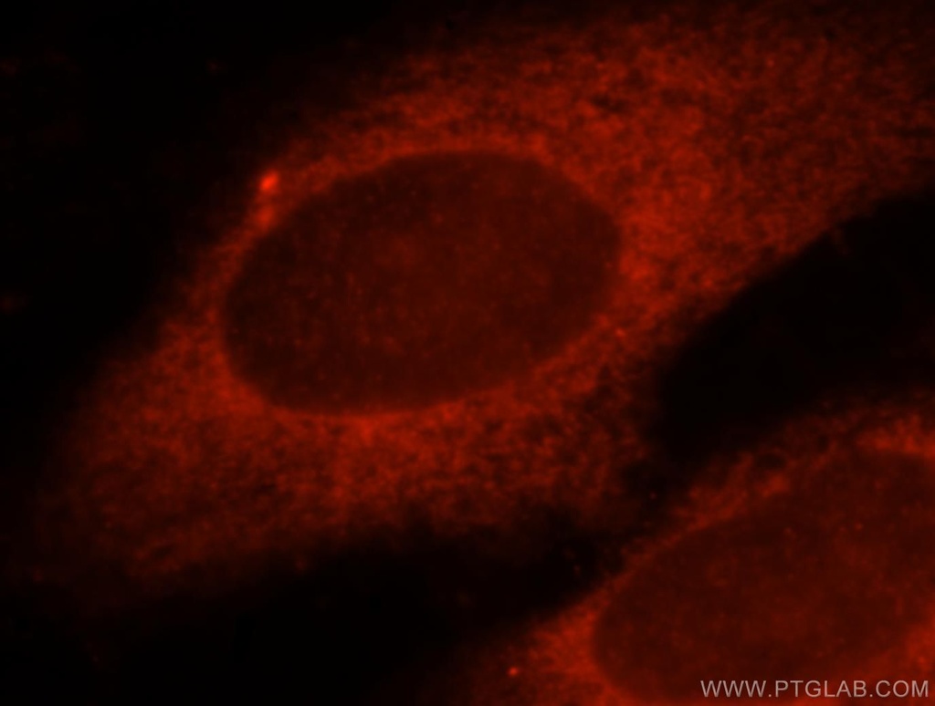 KCTD12 Polyclonal antibody