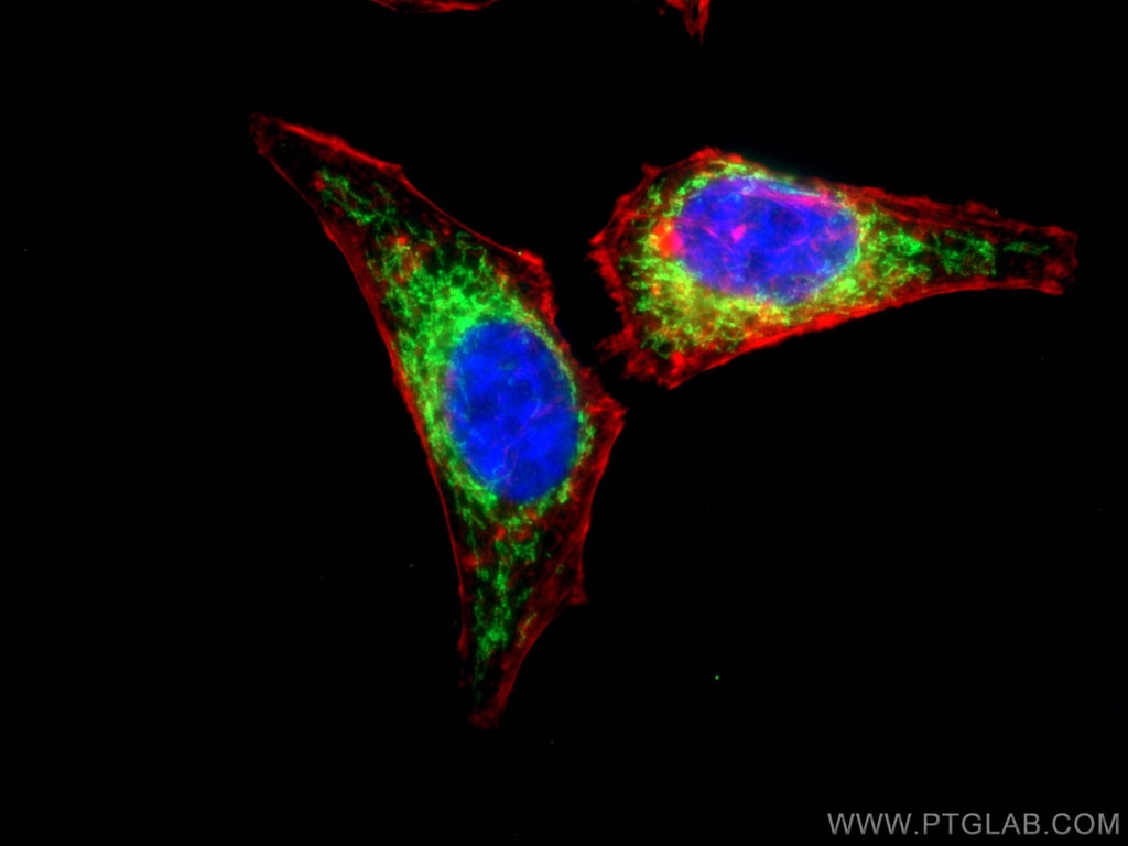 CABC1 Polyclonal antibody