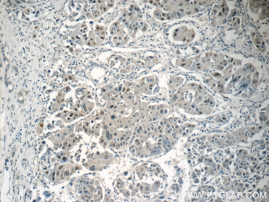 TRPT1 Polyclonal antibody