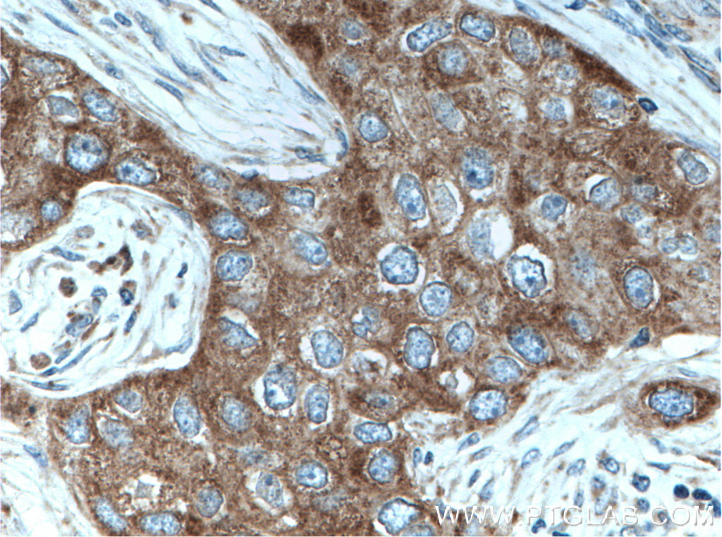 MRPL49 Polyclonal antibody