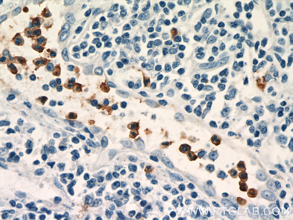 NOXA2/p67phox Polyclonal antibody