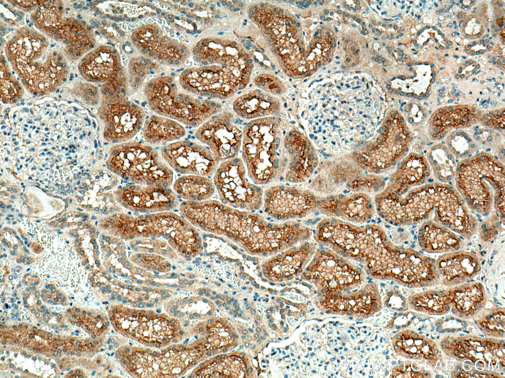 Syntaxin 3 Polyclonal antibody