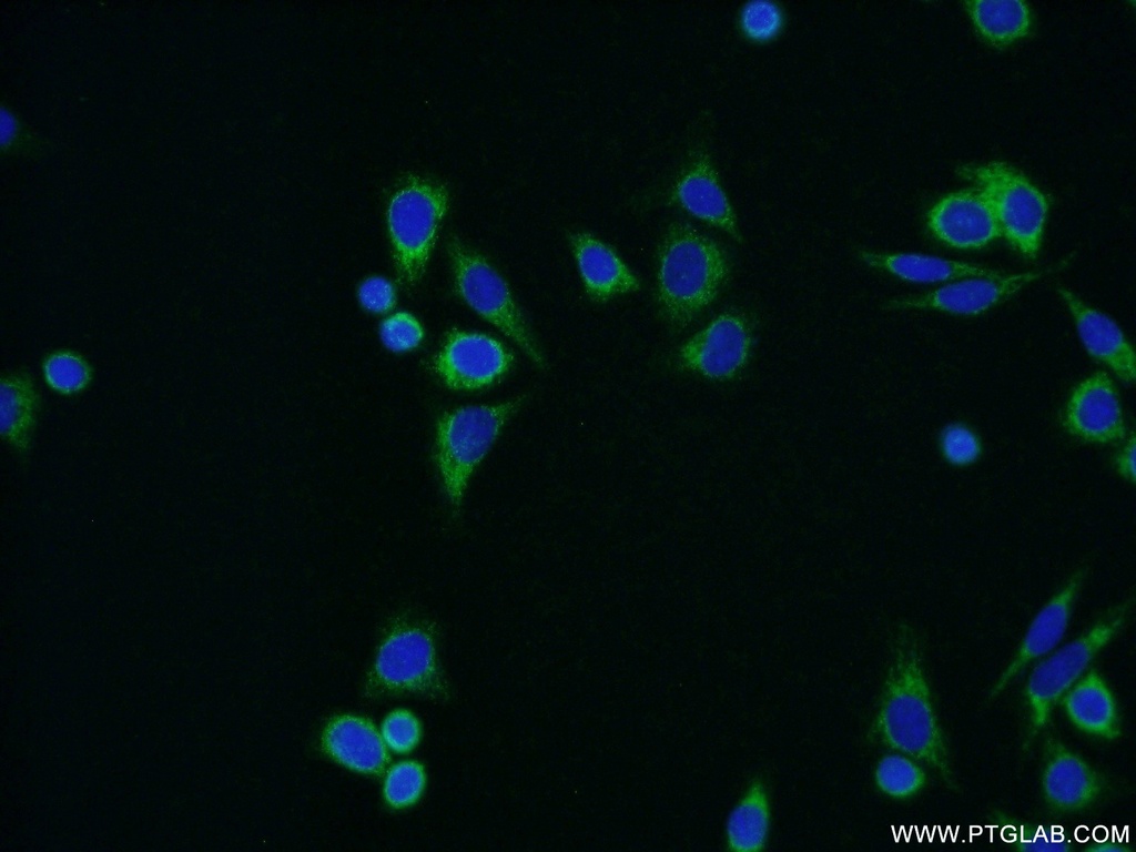 ALDH1B1 Polyclonal antibody