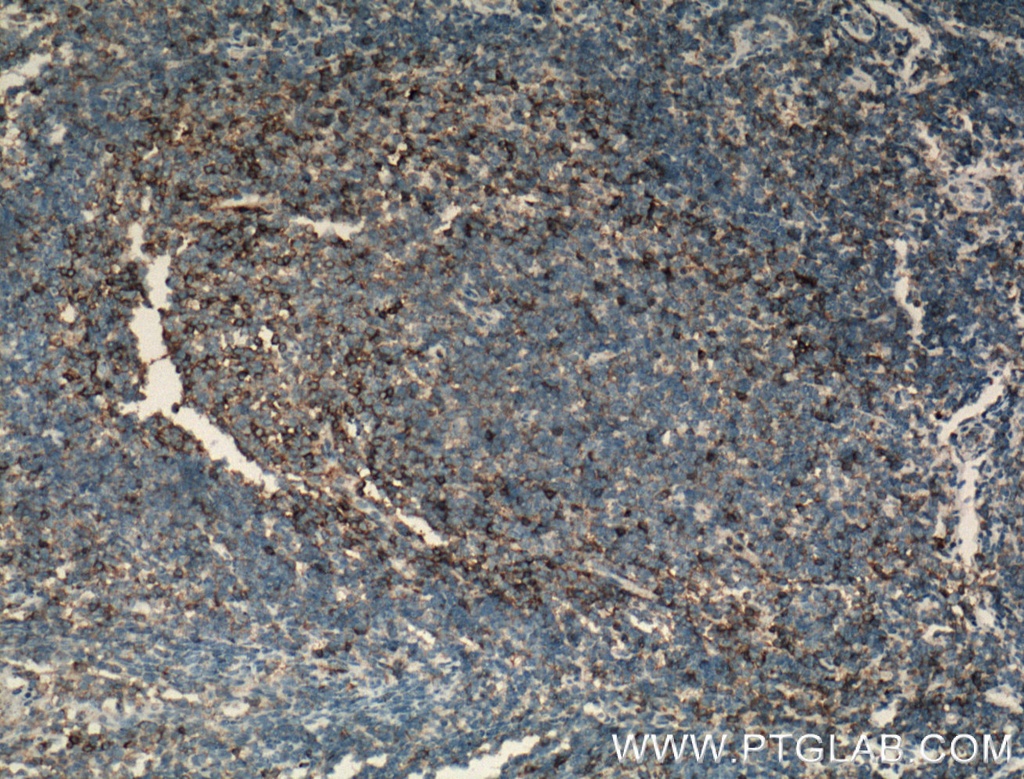 CD11a/Integrin Alpha L Polyclonal antibody
