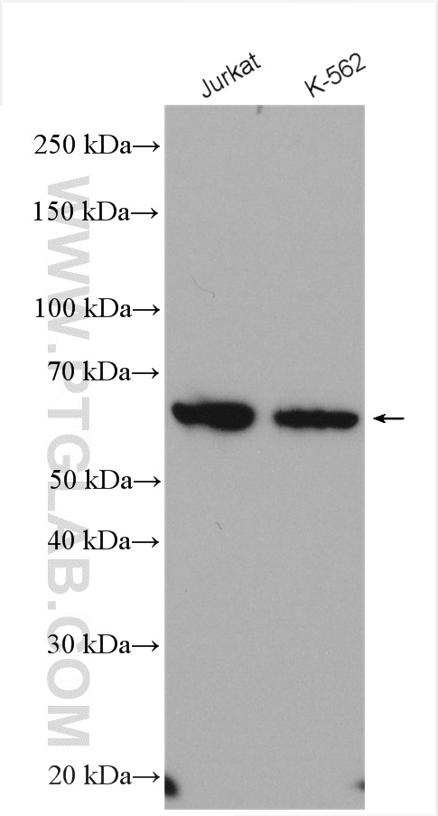 PPP3CC Polyclonal antibody