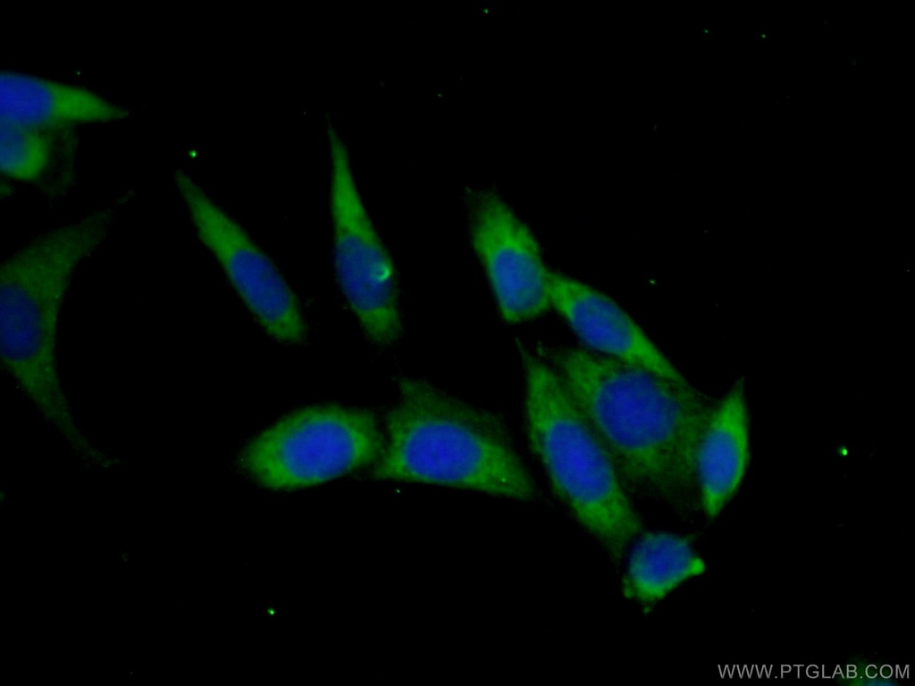 PAIP2 Polyclonal antibody