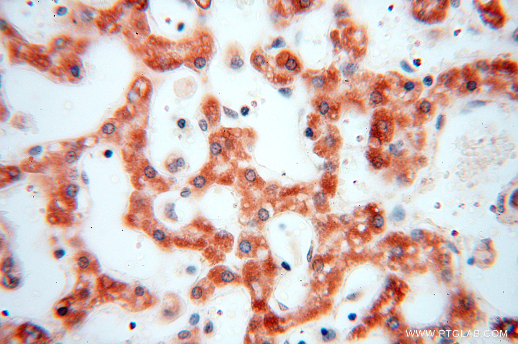 NDUFB10 Polyclonal antibody