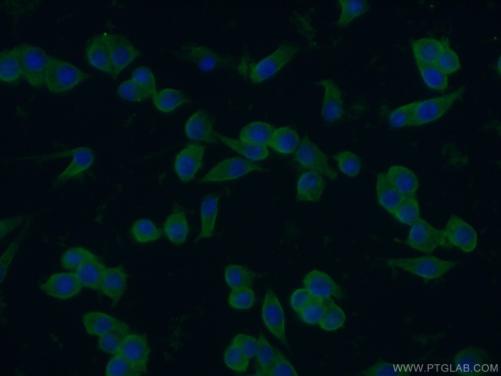 ZAP70 Polyclonal antibody