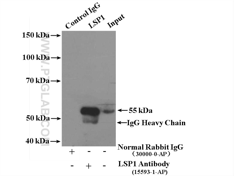 LSP1 Polyclonal antibody