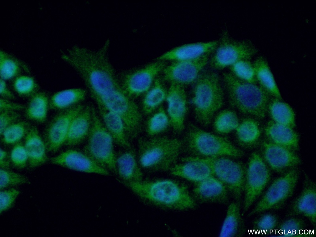 RNASEH1 Polyclonal antibody
