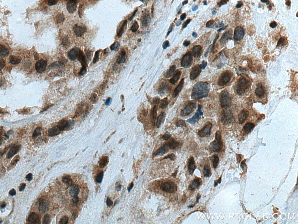 VRK3 Polyclonal antibody