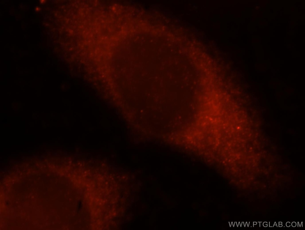 OXSR1 Polyclonal antibody