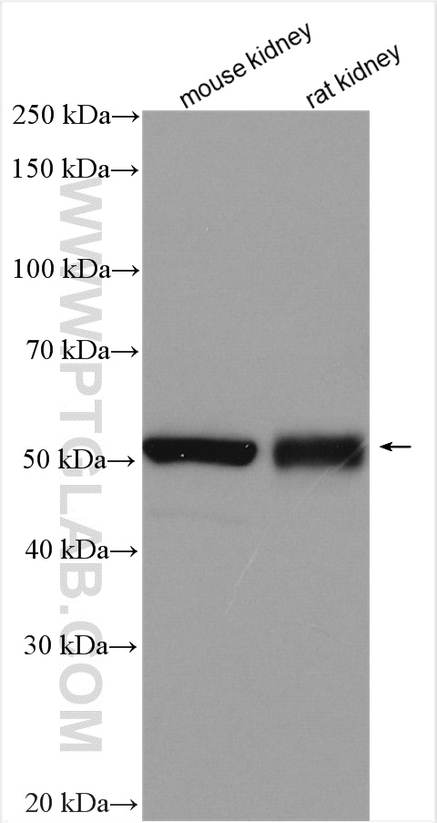 GABRD Polyclonal antibody