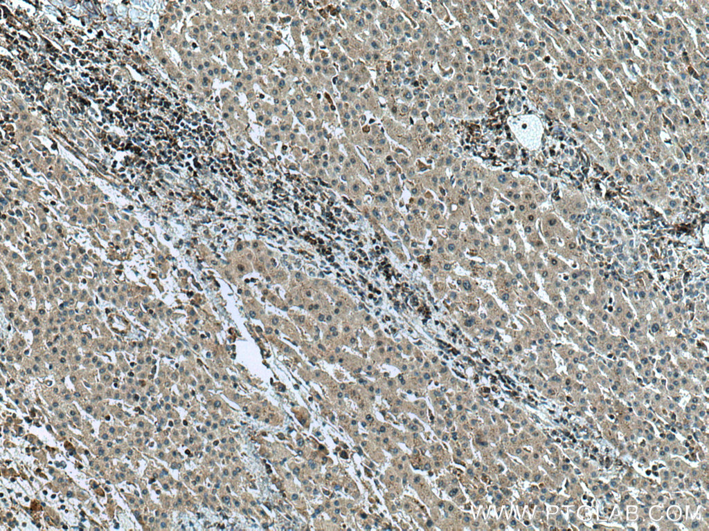GCK Polyclonal antibody